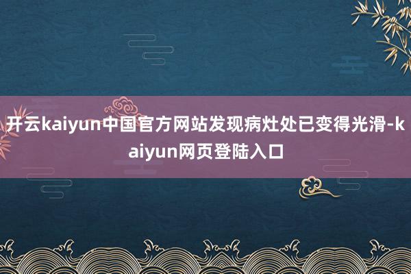 开云kaiyun中国官方网站发现病灶处已变得光滑-kaiyun网页登陆入口